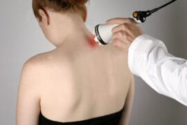 Treatment of cervical osteochondrosis with laser treatment